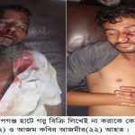 বীরগঞ্জের গোলাপগঞ্জ হাটে বিক্রিত গরুর লিখাই না করাকে কেন্দ্র করে হামলায় আহত-২